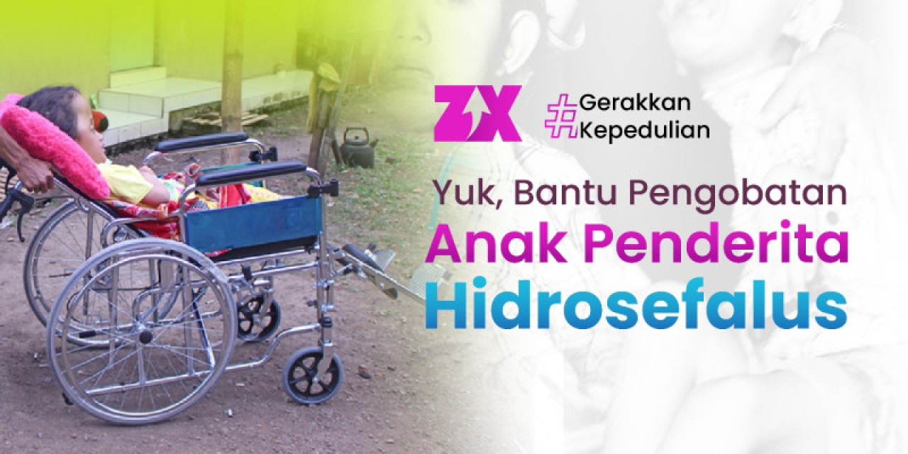 Bantu Pengobatan Anak Penderita Hidrosefalus